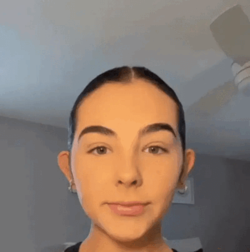 Neviditeľná korekcia uší EarGlow™