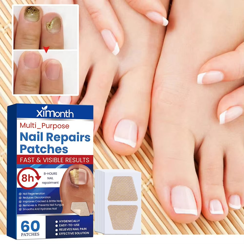 Nočné opravné náplasti NailNurture™ proti plesniam nechtov