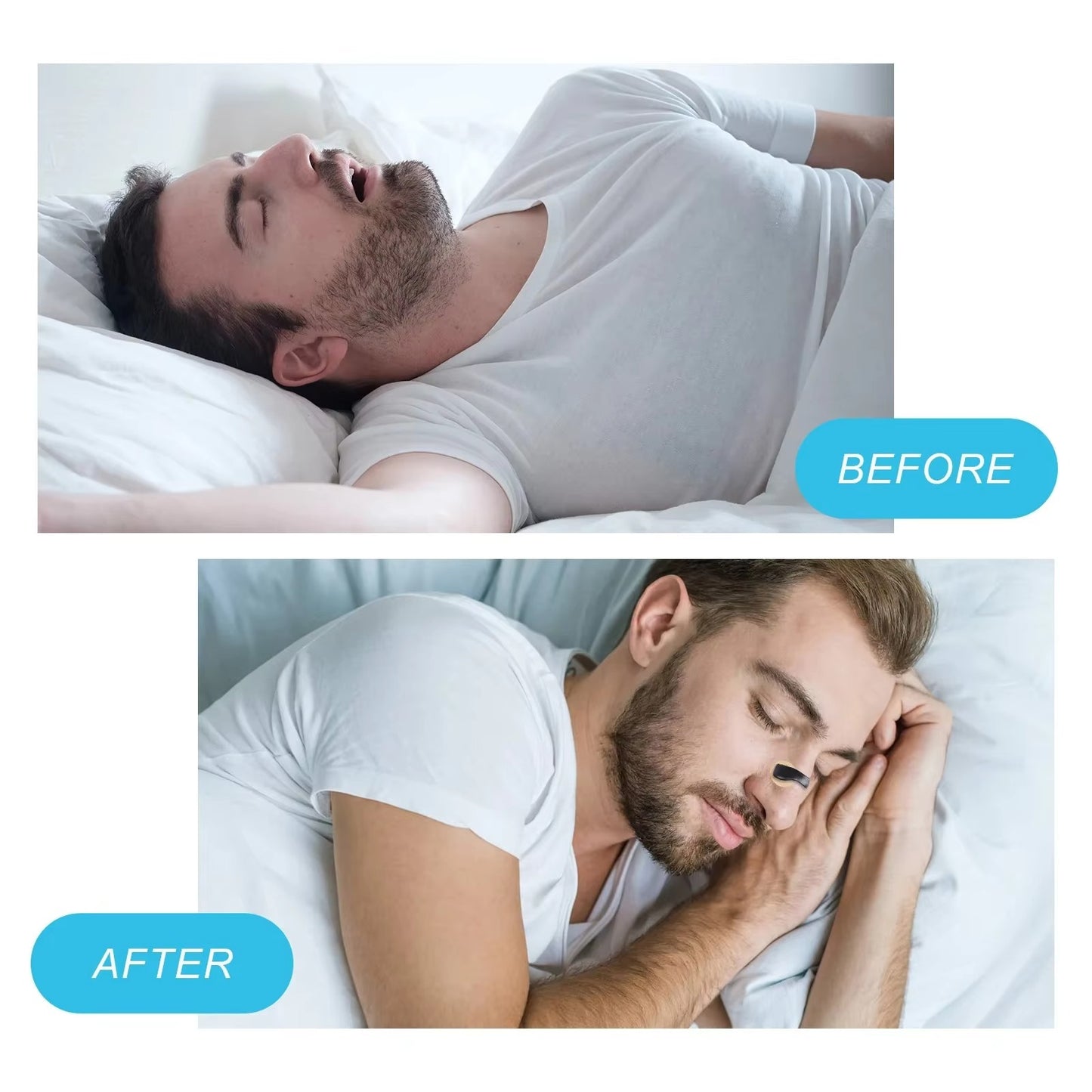Magnetický predlžovač nosa NoSnore Pro™
