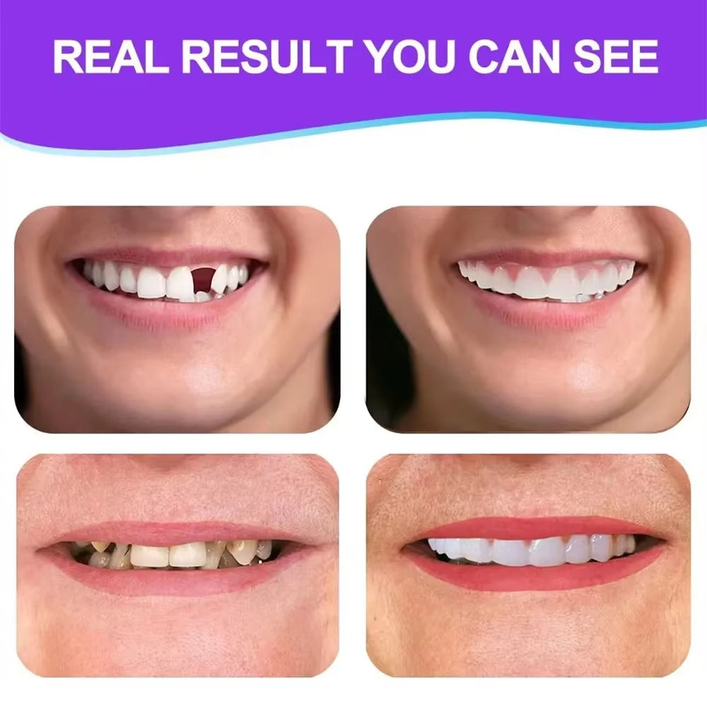 Sada tvárnych zubných protéz Flexi Smile™