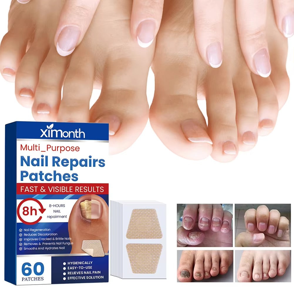 Nočné opravné náplasti NailNurture™ proti plesniam nechtov